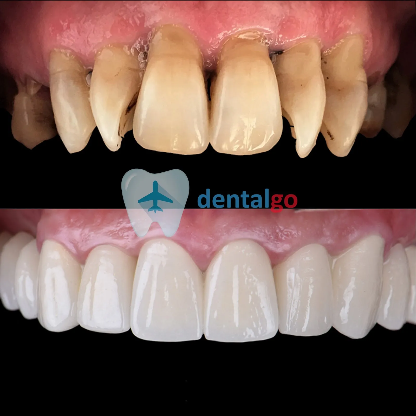 DentalGo Tourism
